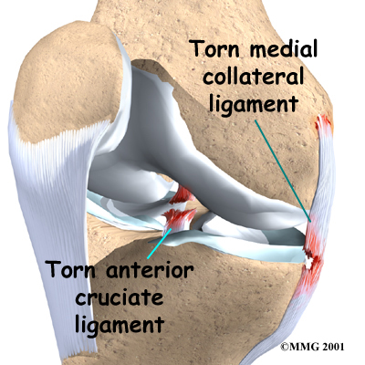 Knee_collateral_anatomy02_medium