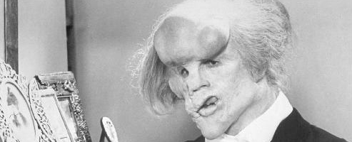 Frank Edgar talks about an injury that turned him into the Elephant man